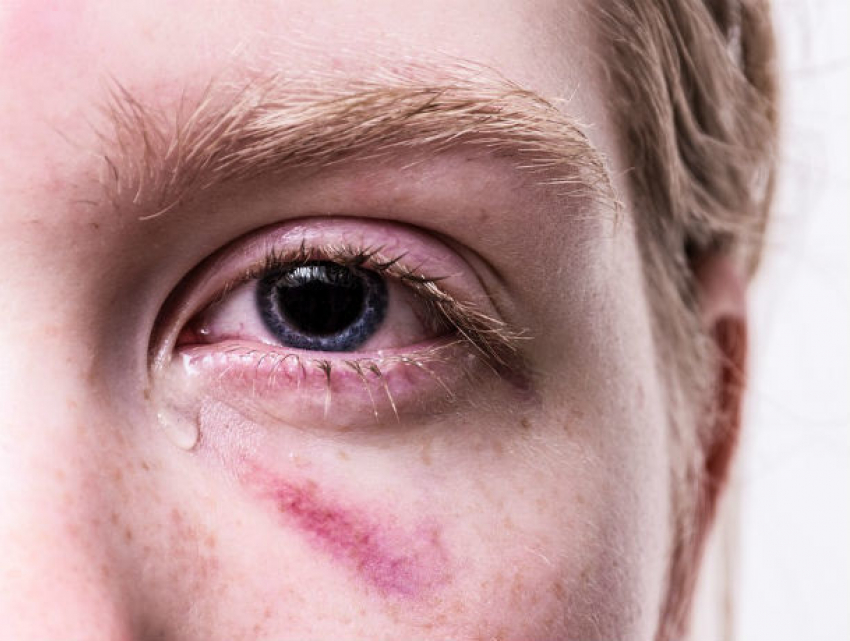 Где в Ростовской области можно получить бесплатную психологическую помощь