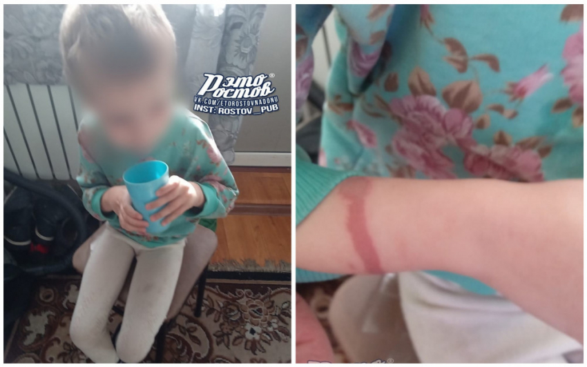 Возбуждено уголовное дело против мамы и отчима, которые морили голодом маленькую дочь в Новошахтинске