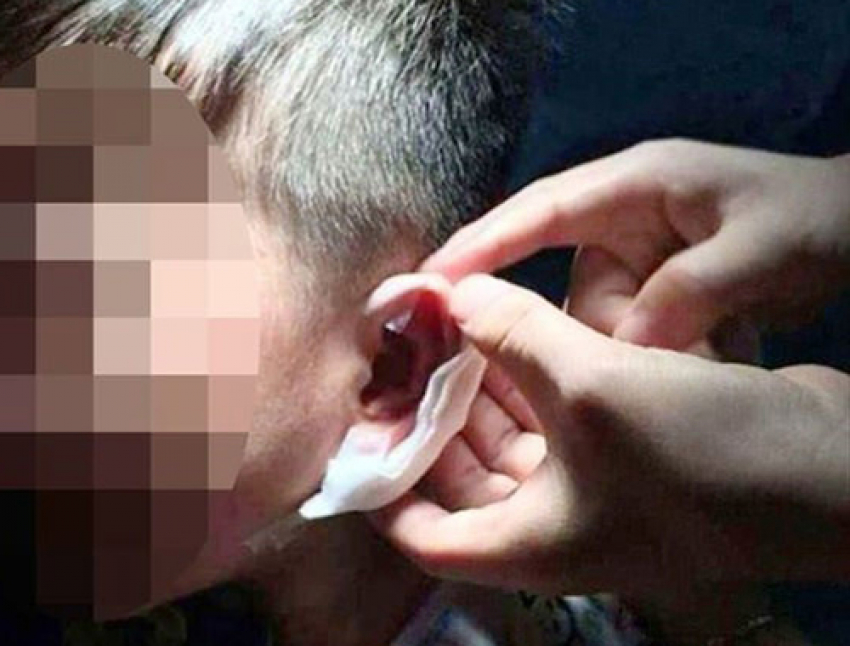 Воспитательница частного сада в Ростове повредила уши ребенку