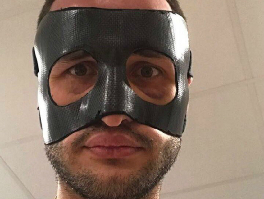 Черную маску надели на футболиста «Ростова» с разбитым носом, назвавшего судей «долбоящерами»