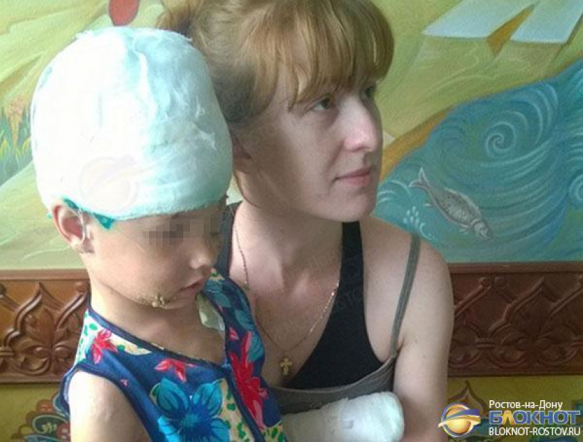 В Ростовской области собака, напав на 5-летнюю девочку, сорвала ей скальп и откусила два пальца. Видео