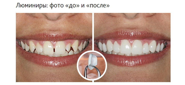 зубы.jpg